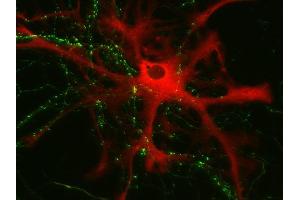 Immunocytochemistry (ICC) image for anti-phosphorylase, Glycogen, Brain (GPBB) (AA 826-842) antibody (ABIN1742514) (PYGB antibody  (AA 826-842))