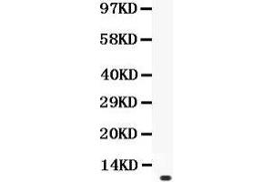 Anti- Prolactin Picoband antibody, Western blotting All lanes: Anti Prolactin  at 0. (Prolactin antibody  (AA 30-226))