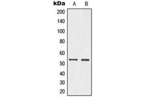 Western blot analysis of p53 (pS15) expression in HeLa UV-treated (A), PC12 (B) whole cell lysates. (p53 antibody  (N-Term, pSer15))