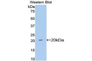 Detection of recombinant SIGLEC12 using Polyclonal Antibody to Sialic Acid Binding Ig Like Lectin 12 (SIGLEC12) (SIGLEC12 antibody  (AA 27-141))