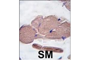 Formalin-fixed and paraffin-embedded human skeletal muscle tissue reacted with GDF8 antibody (N-term ) (ABIN388821 and ABIN2839139) , which was peroxidase-conjugated to the secondary antibody, followed by DAB staining. (MSTN antibody  (N-Term))