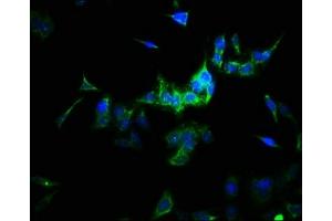 Immunofluorescence staining of HepG2 cells with ABIN7170953 at 1:166, counter-stained with DAPI. (SULT1A3 antibody  (AA 1-295))