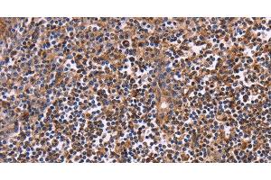 Immunohistochemistry of paraffin-embedded Human tonsil using CLUAP1 Polyclonal Antibody at dilution of 1:50 (CLUAP1 antibody)
