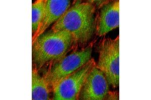 Fluorescent confocal image of C2C12 cell stained with AKT2 Antibody (C-term) (ABIN391022 and ABIN2841192).
