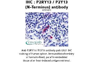 Image no. 1 for anti-Purinergic Receptor P2Y, G-Protein Coupled, 13 (P2RY13) (Extracellular Domain), (N-Term) antibody (ABIN1737760) (Purinergic Receptor P2Y, G-Protein Coupled, 13 (P2RY13) (Extracellular Domain), (N-Term) antibody)