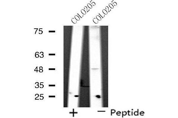 SYT11 antibody  (Internal Region)