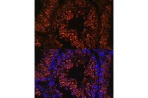 Immunofluorescence analysis of mouse testis using FER1L5 antibody (ABIN7267166) at dilution of 1:100. (FER1L5 antibody  (AA 1350-1670))