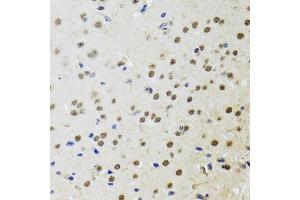 Immunohistochemistry of paraffin-embedded mouse brain using BTK antibody (ABIN5970757) at dilution of 1/100 (40x lens). (BTK antibody)