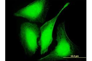 Immunofluorescence of purified MaxPab antibody to GAS2L3 on HeLa cell. (GAS2L3 antibody  (AA 1-694))