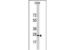 Western blot analysis of BARX1 polyclonal antibody  in CEM cell line lysates (35 ug/lane). (BARX1 antibody  (C-Term))