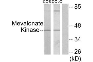 Western blot analysis of extracts from COS-7 cells and COLO205 cells, using Mevalonate Kinase antibody. (MVK antibody  (Internal Region))