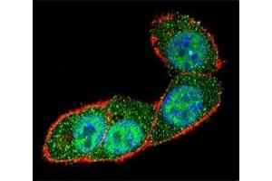 Immunofluorescence (IF) image for anti-SMAD, Mothers Against DPP Homolog 3 (SMAD3) (AA 127-156) antibody (ABIN3032620)