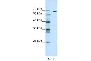 GABRQ antibody used at 0. (GABRQ antibody)