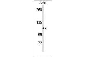 Image no. 1 for anti-Diacylglycerol Kinase, delta 130kDa (DGKD) (C-Term) antibody (ABIN360608) (DGKD antibody  (C-Term))