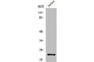 Western Blot analysis of Jurkat cells using MGMT Polyclonal Antibody (MGMT antibody  (N-Term))