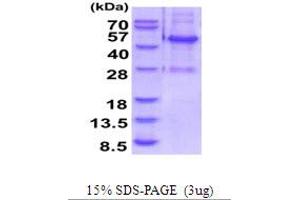 SDS-PAGE (SDS) image for ELAC1 (ELAC1) (AA 1-363) protein (His tag) (ABIN5854274) (ELAC1 Protein (ELAC1) (AA 1-363) (His tag))