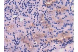 Detection of ACE in Human Kidney Tissue using Polyclonal Antibody to Angiotensin I Converting Enzyme (ACE) (Angiotensin I Converting Enzyme 1 antibody  (AA 814-1071))