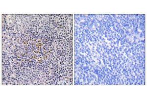 Immunohistochemistry (IHC) image for anti-X-Ray Repair Complementing Defective Repair in Chinese Hamster Cells 3 (XRCC3) (Internal Region) antibody (ABIN1850510) (XRCC3 antibody  (Internal Region))