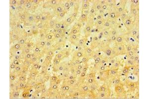 Immunohistochemistry of paraffin-embedded human liver tissue using ABIN7148440 at dilution of 1:100 (CRX antibody  (AA 120-285))