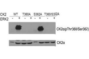 Western blot of CK2α(Phospho- Thr360/Ser362) antibody and CK2α antibody in vitro kinase assay. (CSNK2A1/CK II alpha antibody  (pSer362, pThr360))