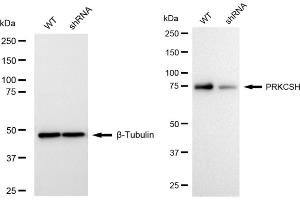 Western blotting analysis using PRKCSH antibody (ABIN7799984).