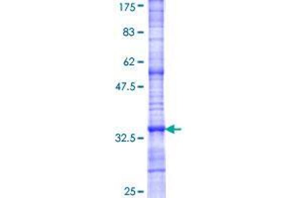 TAS2R10 Protein (AA 1-124) (GST tag)