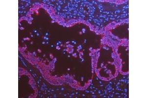 IF analysis of Cytokeratin 8/KRT8 using anti-Cytokeratin 8/KRT8 antibody (ABIN5518853). (KRT8 antibody  (AA 107-325))