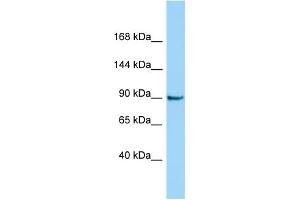 Host: Rabbit Target Name: CRNKL1 Sample Type: Jurkat Whole Cell lysates Antibody Dilution: 1. (CRNKL1 antibody  (C-Term))