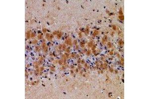 Immunohistochemical analysis of Latexin staining in rat brain formalin fixed paraffin embedded tissue section. (Latexin antibody)