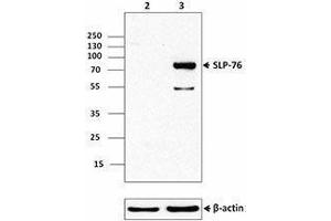 Western Blotting (WB) image for anti-Lymphocyte Cytosolic Protein 2 (SH2 Domain Containing Leukocyte Protein of 76kDa) (LCP2) (AA 216-434) antibody (ABIN2666114) (LCP2 antibody  (AA 216-434))