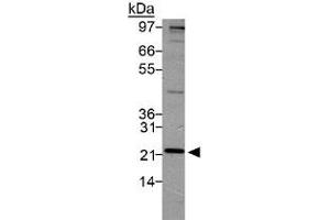 Western blot analysis of PSMD10 in HeLa lysate using with PSMD10 polyclonal antibody . (PSMD10 antibody  (AA 100-200))