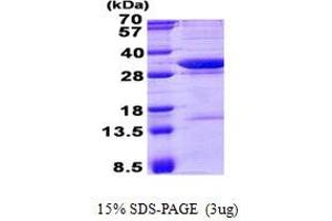 Image no. 1 for Neutral Cholesterol Ester Hydrolase 1 (NCEH1) protein (His tag) (ABIN1098788)
