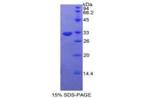 SDS-PAGE analysis of Human Protein Kinase C Eta Protein. (PKC eta Protein)