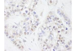 anti-Melanoma Antigen Family D, 2 (MAGED2) (AA 50-100) antibody