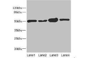 Western blot All lanes: CHN1 antibody at 6.