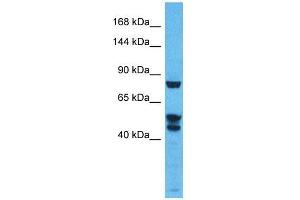 Host:  Rabbit  Target Name:  KDM3B  Sample Type:  Thymus Tumor lysates  Antibody Dilution:  1. (KDM3B antibody  (N-Term))