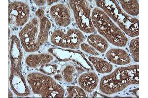 Image no. 3 for anti-Melan A (MLANA) antibody (ABIN1499425) (MLANA antibody)