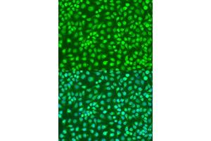 Immunofluorescence (IF) image for anti-Inhibitor of kappa Light Polypeptide Gene Enhancer in B-Cells, Kinase beta (IKBKB) (AA 517-756) antibody (ABIN6142280)