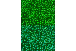 Immunofluorescence analysis of U2OS cells using IKBKB antibody. (IKBKB antibody  (AA 517-756))