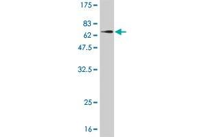 Western Blot detection against Immunogen (61. (AKR1A1 antibody  (AA 1-325))