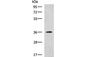 Western blot analysis of Human cerebella tissue lysate using ATP1B2 Polyclonal Antibody at dilution of 1:650 (ATP1B2 antibody)