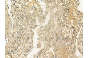 ABIN6257866 and ABIN6274832 at 1/100 staining human normal lung tissue by IHC-P.