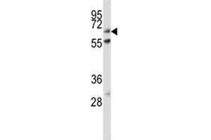 ALP antibody western blot analysis in HeLa lysate (Alkaline Phosphatase antibody  (AA 282-309))