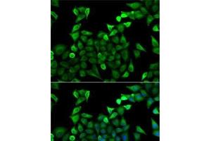 Immunofluorescence analysis of A-549 cells using TPSAB1 Polyclonal Antibody (TPSAB1 antibody)