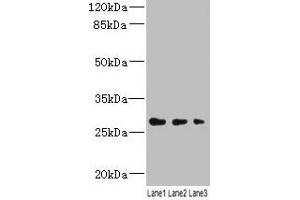 Western blot All lanes: LRRC57 antibody at 4 μg/mL Lane 1: Mouse liver tissue Lane 2: Mouse kidney tissue Lane 3: Mouse lung tissue Secondary Goat polyclonal to rabbit IgG at 1/10000 dilution Predicted band size: 27 kDa Observed band size: 27 kDa
