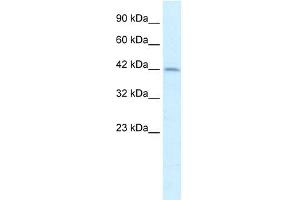 WB Suggested Anti-PAX3 Antibody Titration:  2. (Paired Box 3 antibody  (Middle Region))