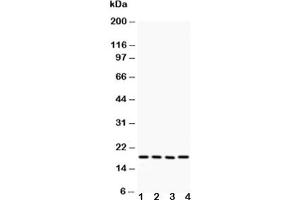 Western blot testing of Caveolin-2 antibody and Lane 1:  HeLa (Caveolin 2 antibody  (AA 1-162))