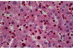 Human Liver: Formalin-Fixed, Paraffin-Embedded (FFPE) (FZR1 antibody  (AA 1-494))