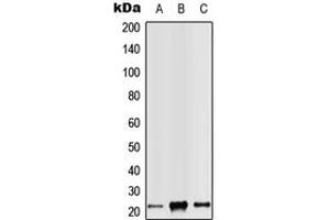 Western blot analysis of RAB14 expression in Jurkat (A), Raw264.