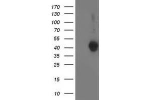 Western Blotting (WB) image for anti-Leucine Carboxyl Methyltransferase 1 (LCMT1) antibody (ABIN1499106) (LCMT1 antibody)